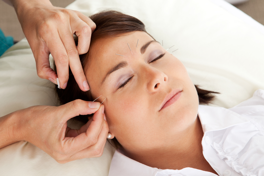 Kosmeettisessa akupunktiossa ei hoideta pelkkää pintaa, vaan tarkoituksena on vaikuttaa koko kehon toimintaan.